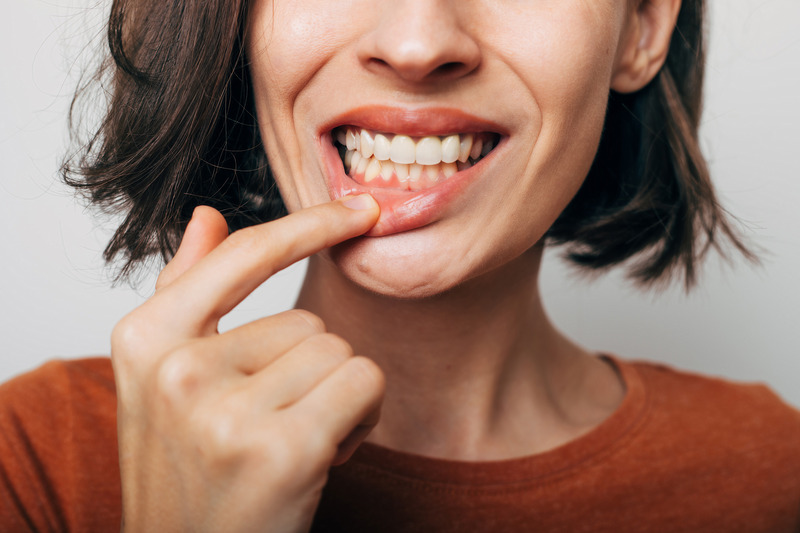 Patient checking their gums in the mirror before cosmetic dentistry